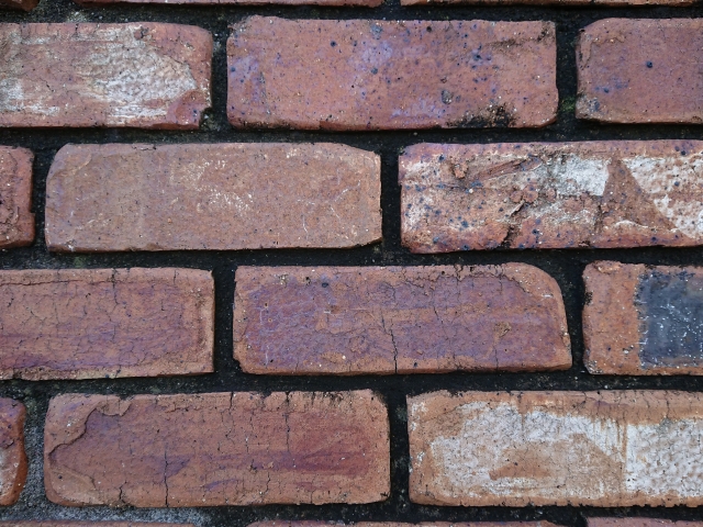 難病の請求について考える　シェーグレン症候群